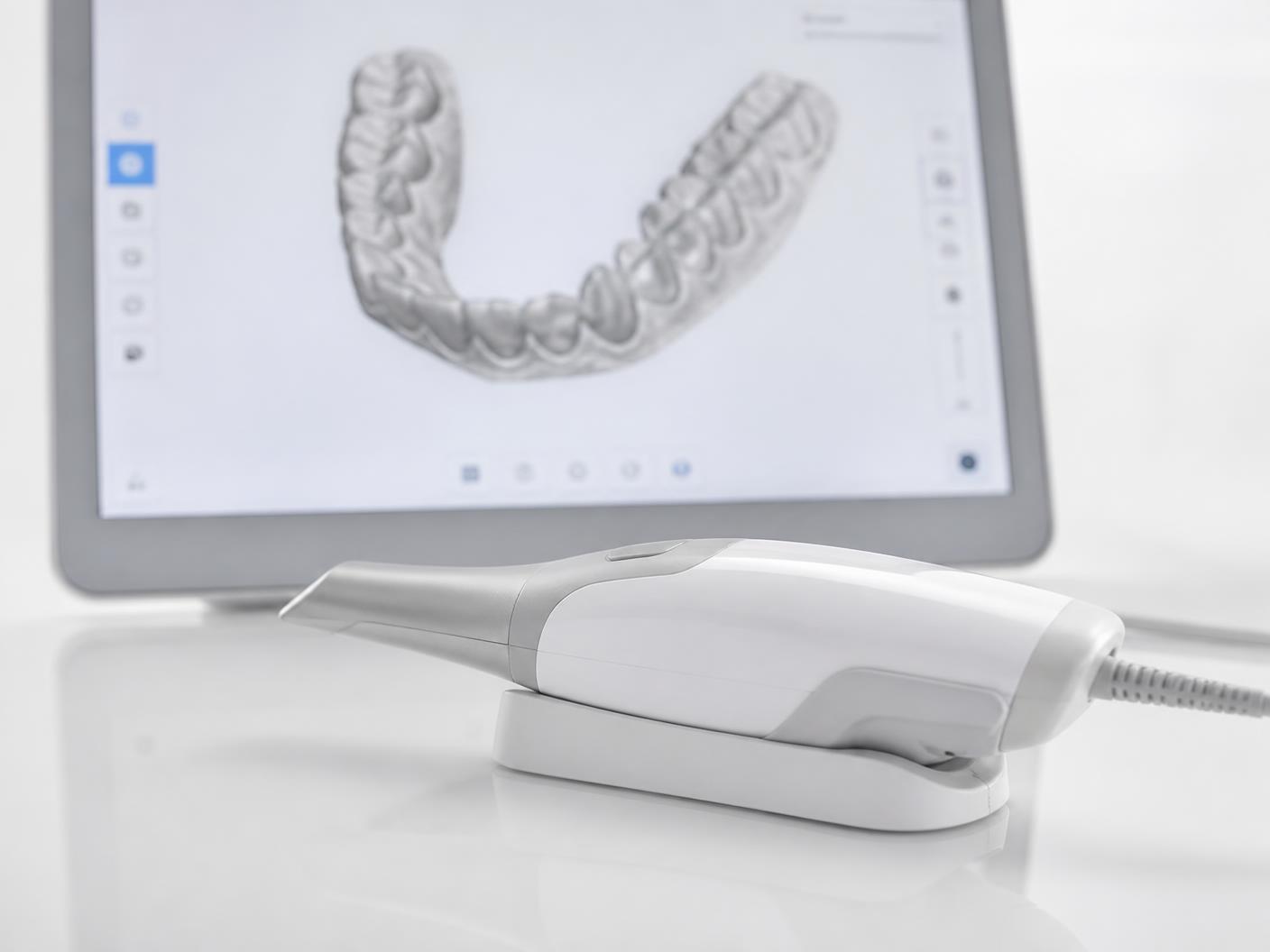 Digital intraoral scanner beside a screen showing a three-dimensional dental scan